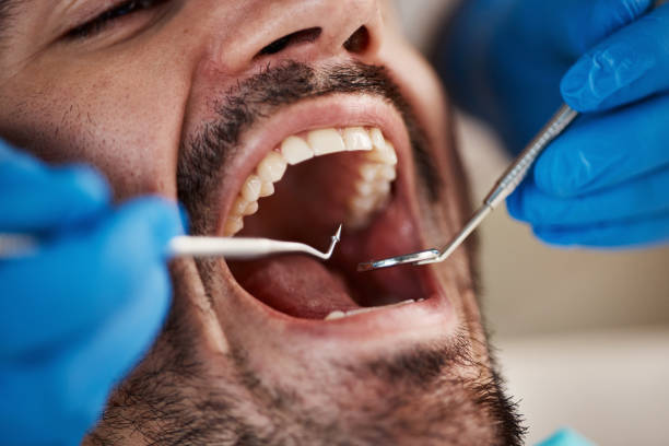 Best Tooth Pain Emergency Relief  in Fort Mckinley, OH