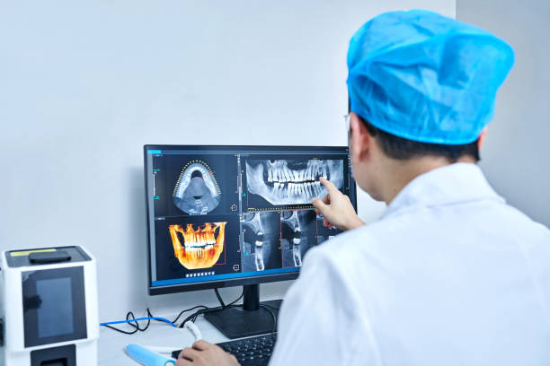 Best Chipped Tooth Repair Near Me  in Fort Mckinley, OH